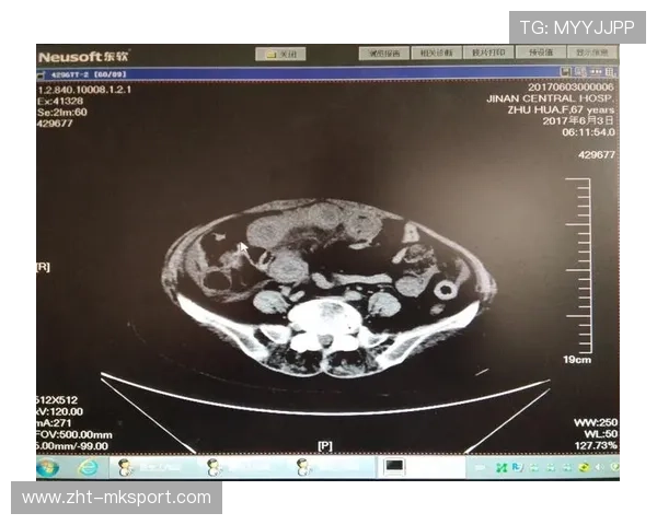 CT前压失败被瞬间反杀